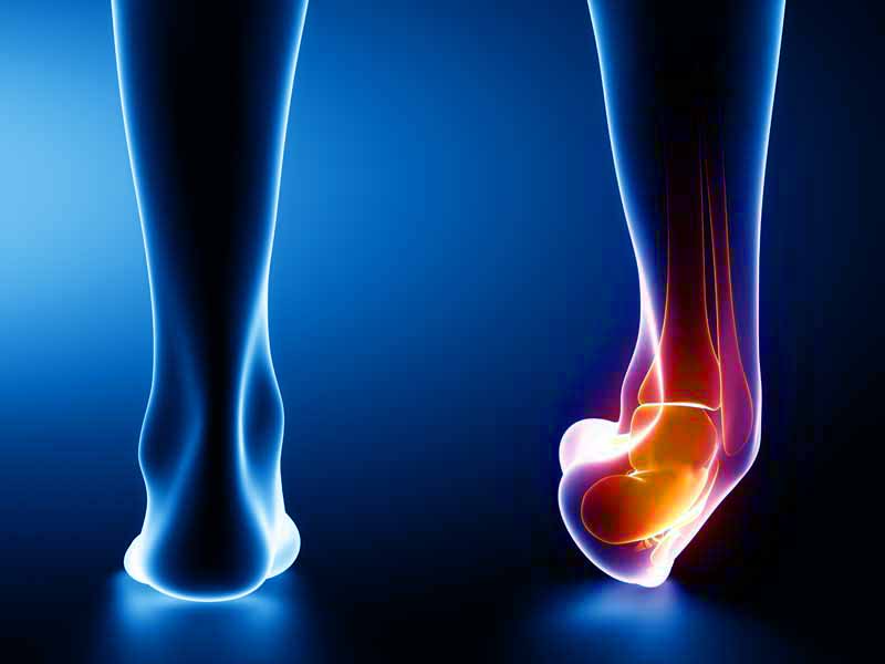 common sport injuries ankle