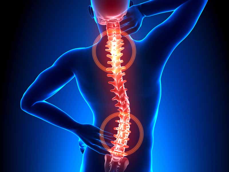 common sport back and spine injuries